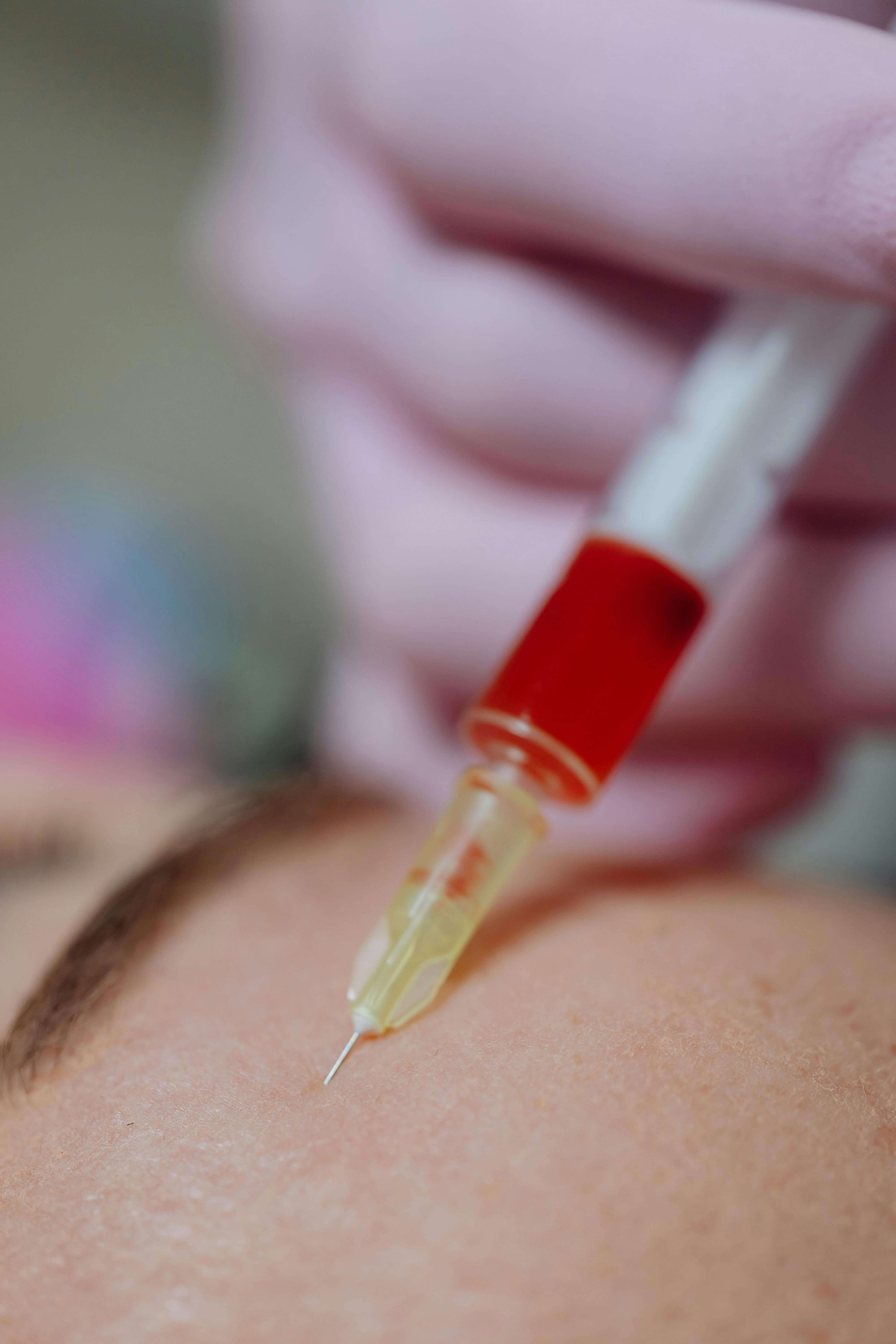 botox-biostimulators-2.jpg