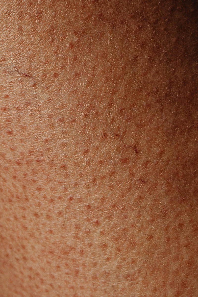 skin-closeup.jpg