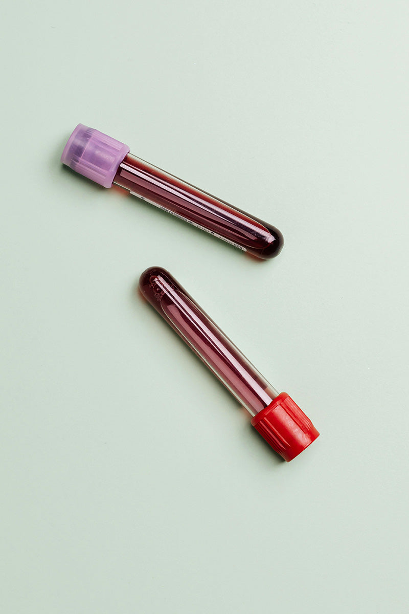 biomarker-tests-blood-draw.jpg