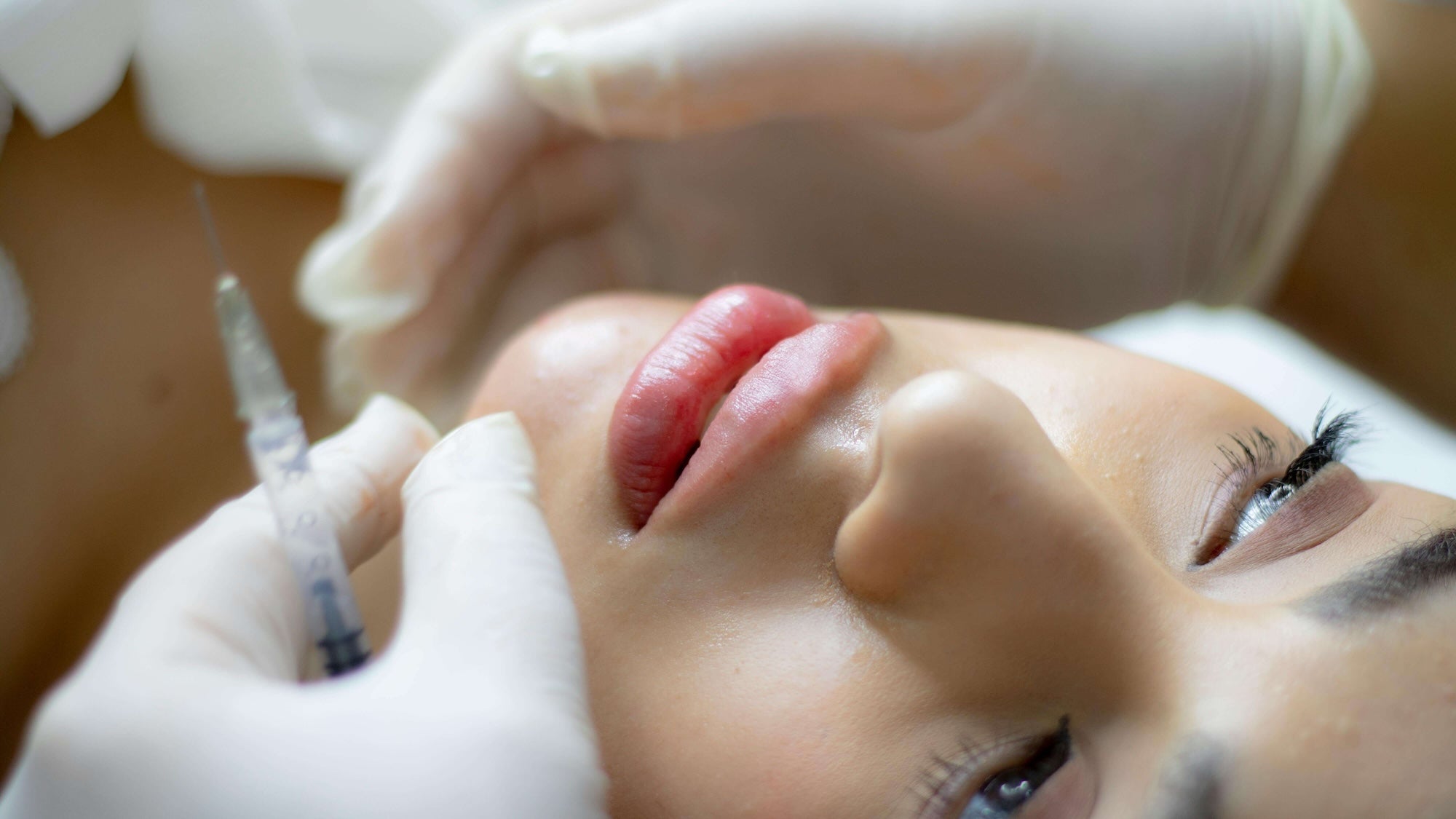Supernatural | Botox + Biostimulators